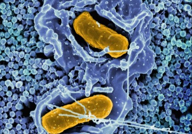 national-institute-of-allergy-and-infectious-diseases-zna7xrjnc6k-unsplash_1786965824-f3f2a37916a014ecb040464bbd5c1b50.jpg